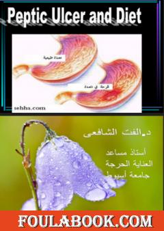 قرحة المعدة والتغذية