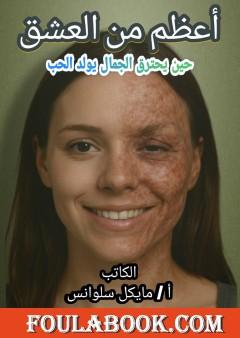 أعظم من العشق - حين يحترق الجمال يولد الحب